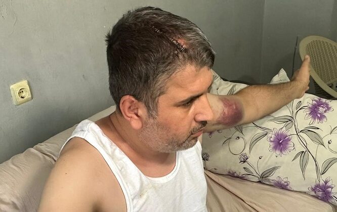 DAYIDAN MEYDAN DAYAĞI!