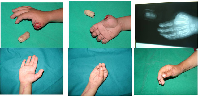 Soruyoruz: Madem hakkınızdı niye iade ettiniz?