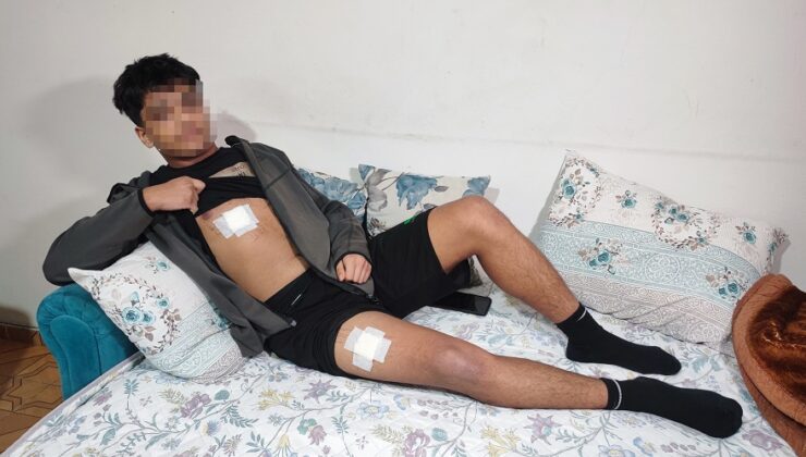 Önce dövüldü sonra bıçaklandı