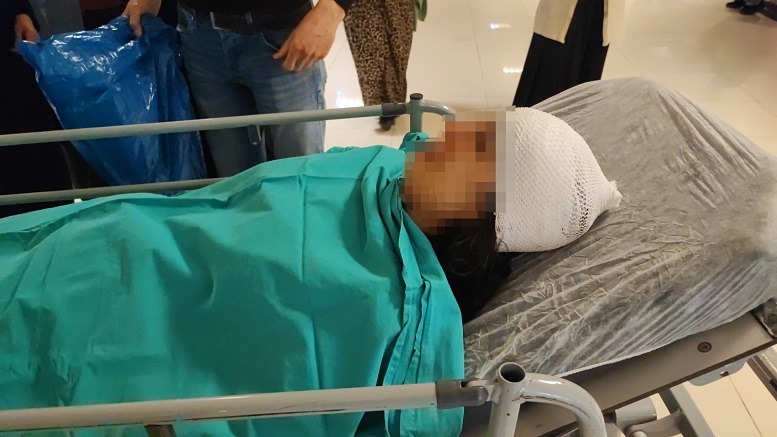 SOKAK KÖPEKLERİNİN SALDIRISINA UĞRADI